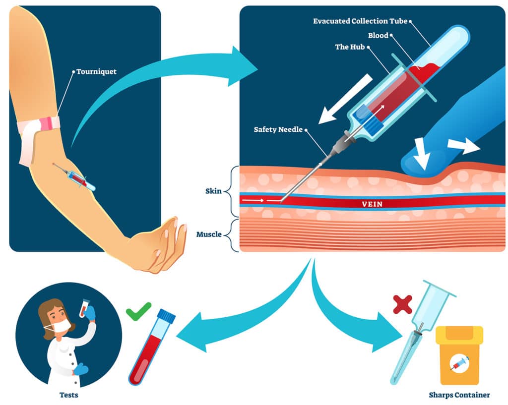 E Phlebotomy Training Online and Classroom Phlebotomy Training E Phlebotomy Training Online and Classroom Phlebotomy Training
